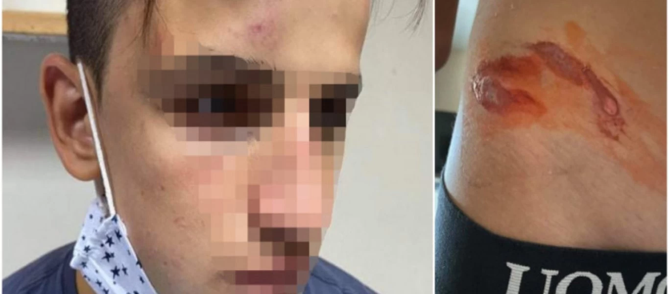 Γαλάτσι: Συνελήφθησαν τέσσερις για τον ξυλοδαρμό του 17χρονου - Ένας ανήλικος (φώτο)